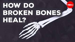 What happens when you break a bone? - Gurpreet Baht and Natalie Pang