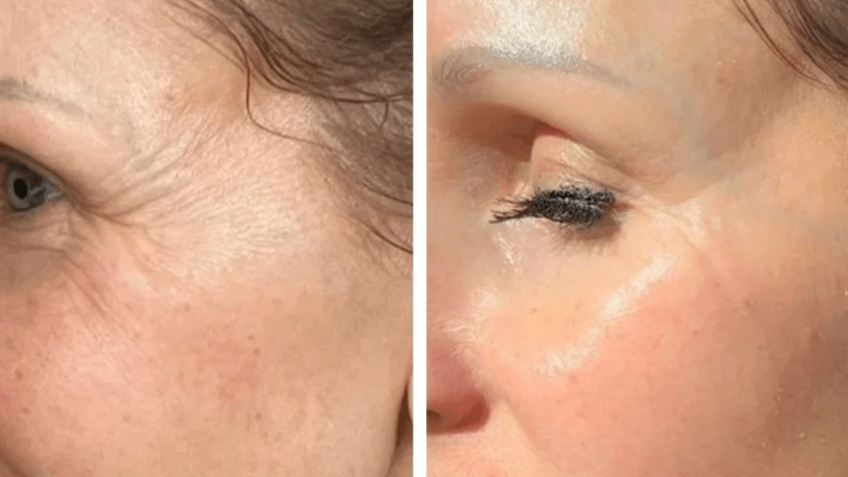 LED Face Mask With Big Discount Has Women Looking Good Without Makeup