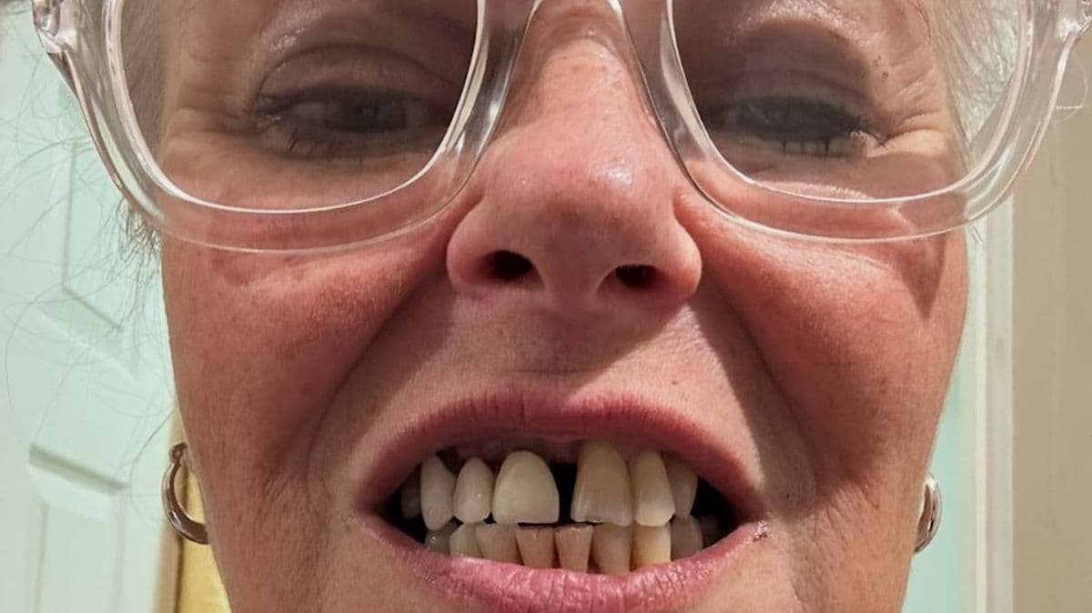 A £12,000 dental transformation changed my life