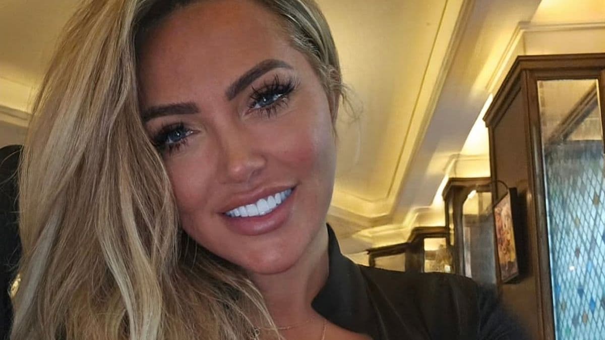 Big Brother Star Attacked by XL Bully Dog