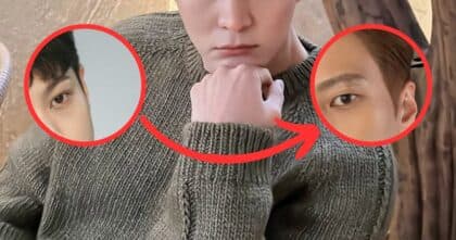 Actor Cancels Plastic Surgery, Returns to Youthful Look