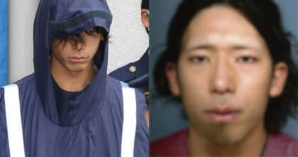 A Man Did Plastic Surgery On Himself For A Shocking Reason