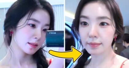 Red Velvet's Irene Removes a Big Pimple on Camera