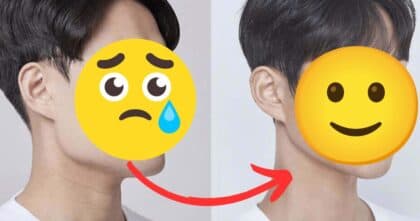 Korean Bus Driver Changes His Looks With Surgery