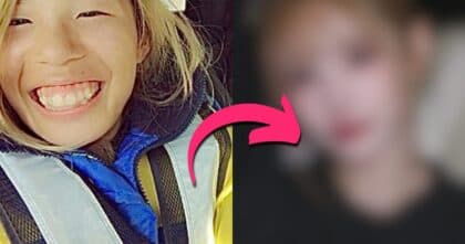 The Trauma Behind Airi Hirase’s 25 Plastic Surgeries