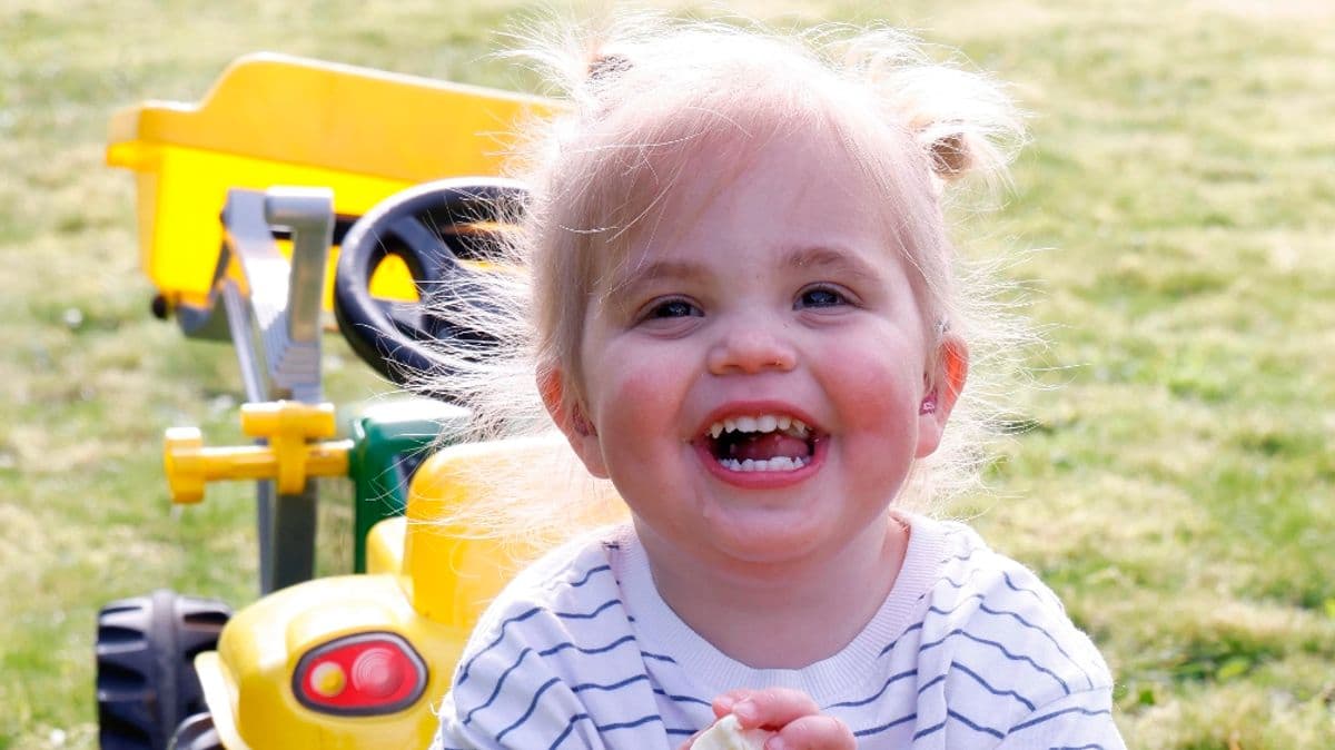 Sanfilippo syndrome - tragedy of ‘childhood dementia’ and its early warning signs