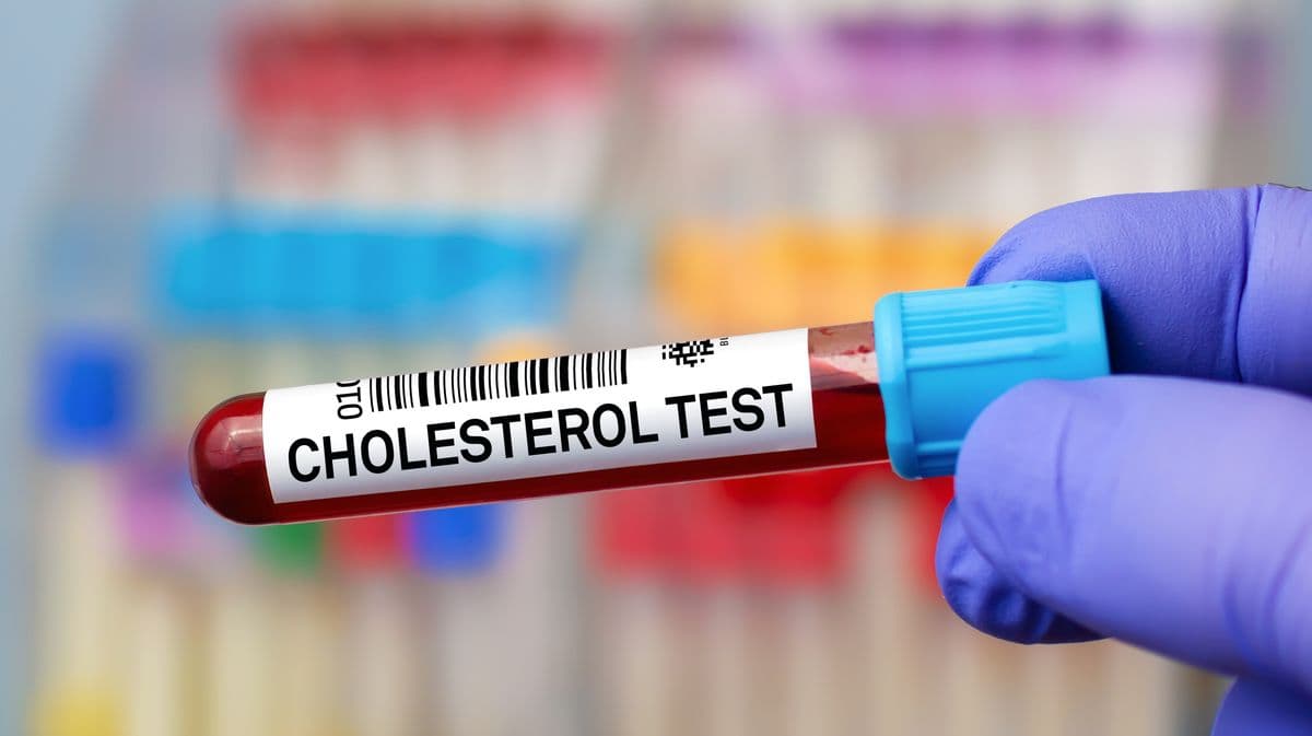 NHS Explains How to Lower High Cholesterol